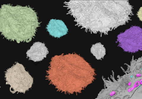 Correlative Light & Electron Microscopy (CLEM) 